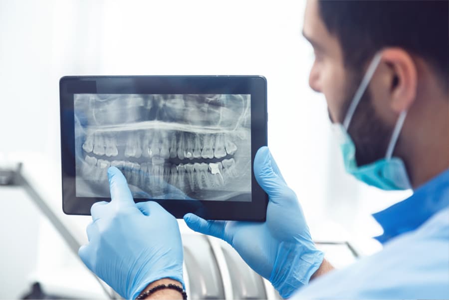 ¿Qué diferencias existen entre la radiología digital y el TAC dental?S