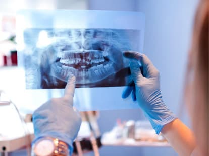 Radiología digital y TAC dental en Poio